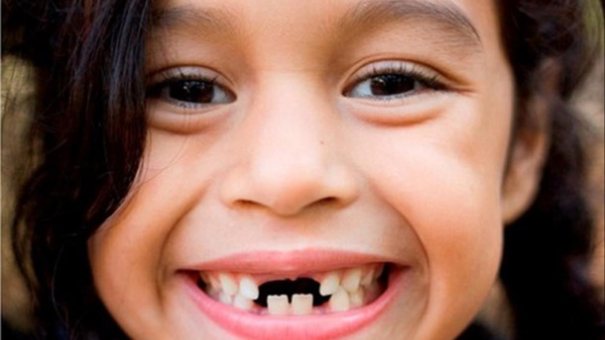 Nếu bạn mơ thấy hàm răng bị rụng, đó là dấu hiệu của sự thay đổi mạnh mẽ trong cuộc sống