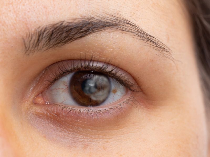 Phụ nữ thường rất mạnh mẽ nếu sở hữu nốt ruồi ở mắt trái
