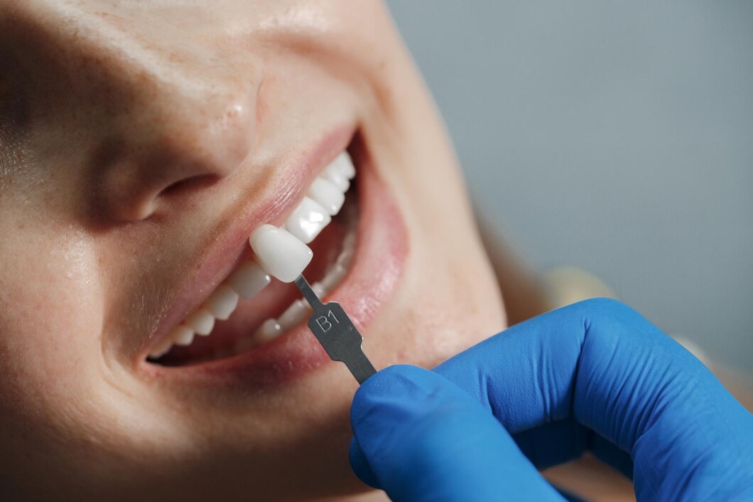 Điều trị răng mẻ để tránh các điềm xấu trong tương lai