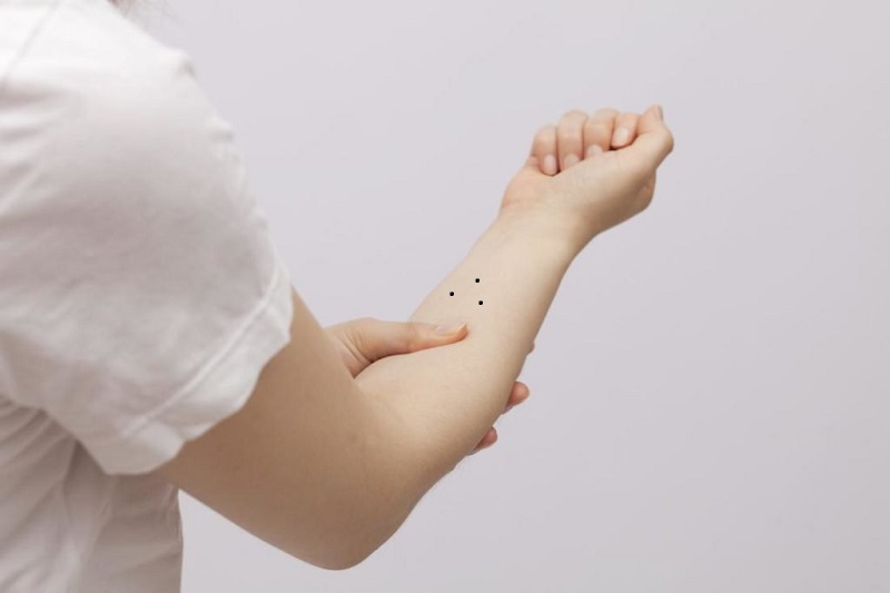 3 nốt ruồi tạo thành tam giác trên cánh tay thường báo hiệu mang lại điềm lành
