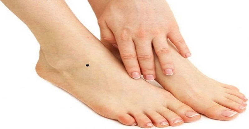 Những nốt ruồi ở mu bàn chân thường không mang điều gì tốt lành